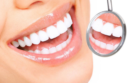 Blanqueamiento dental