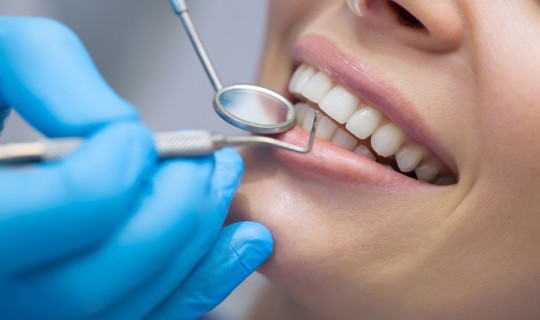 Limpieza bucal profesional