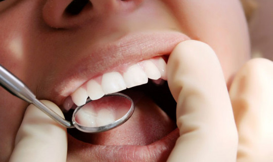 Caries: Historia, progresión y prevención – Higienistas VITIS