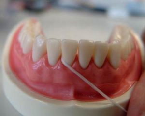 uso de la seda o cinta dental 4