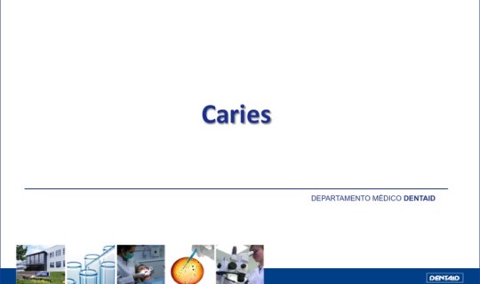 Caries: prevalencia, etiopatogenia, diagnóstico y prevención