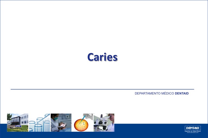 Caries: prevalencia, etiopatogenia, diagnóstico y prevención