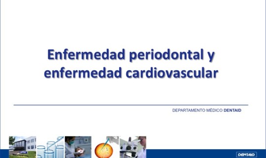 Enfermedad periodontal y enfermedad cardiovascular