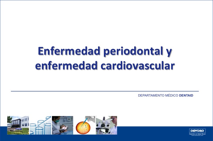 Enfermedad periodontal y enfermedad cardiovascular