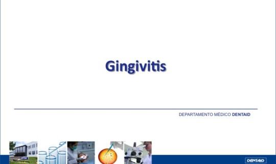 Gingivitis