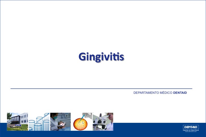 Gingivitis