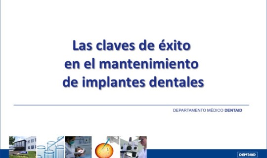Las claves de éxito en el mantenimiento de implantes dentales