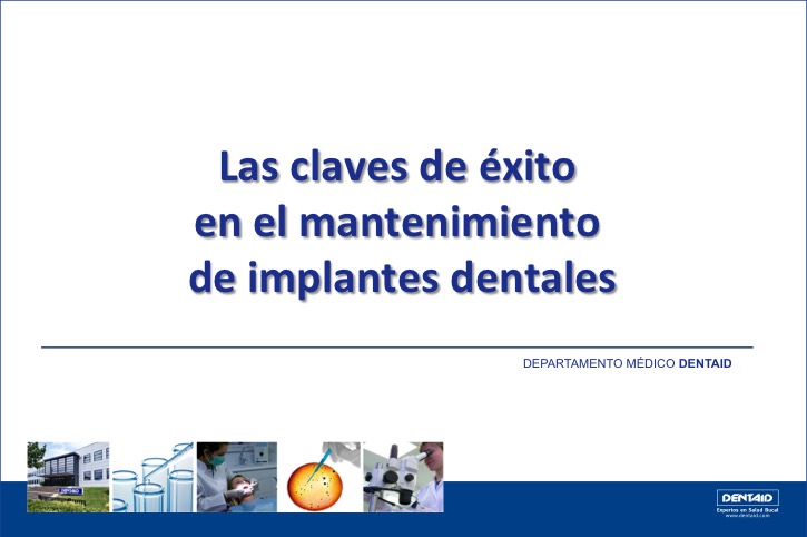 Las claves de éxito en el mantenimiento de implantes dentales