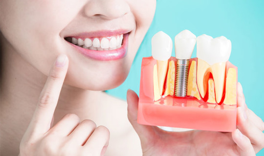 PERIIMPLANTITIS: Diagnóstico, tratamiento y prevención
